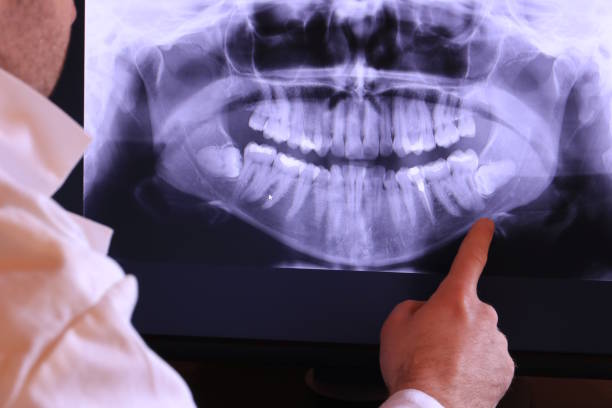 Best Emergency Dentist for Knocked-Out Tooth in Goulding, FL