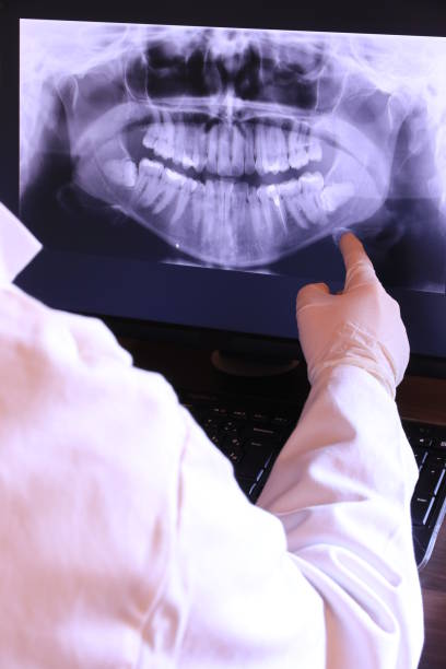 Best Emergency Dentist for Lost Fillings or Crowns in Goulding, FL